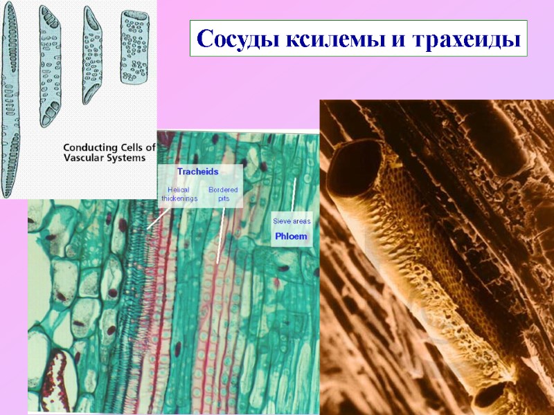 Сосуды ксилемы и трахеиды